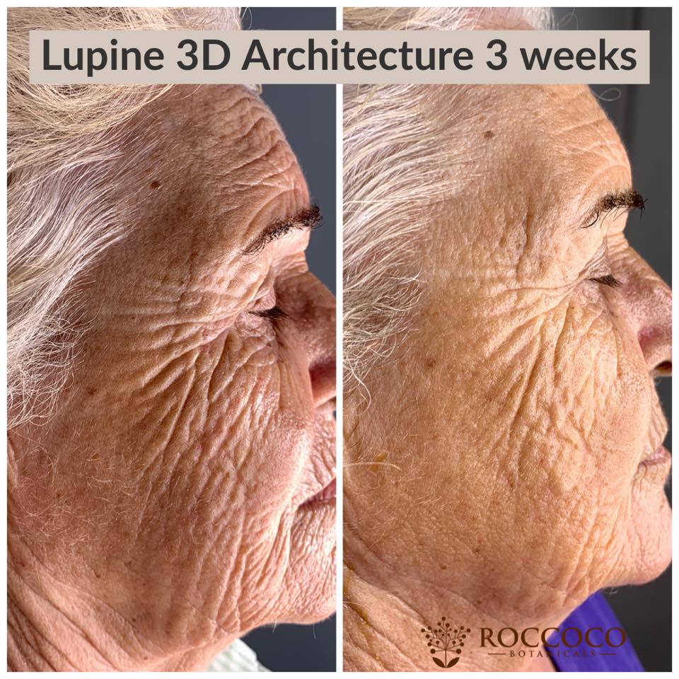 Lupine 3D Architecture
