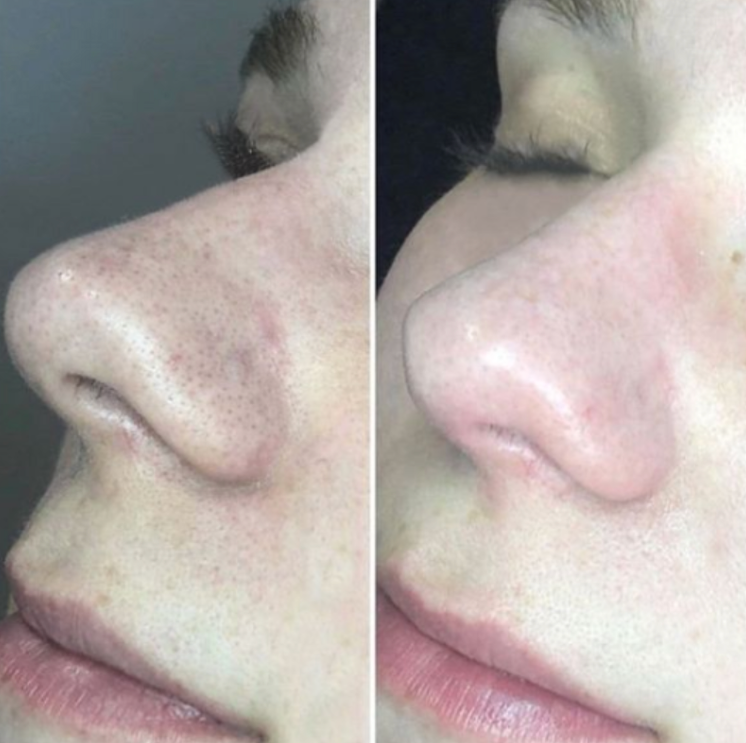 Pore Cleansing Oil